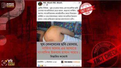 সারজিস আলমের হামলায় সাংবাদিক আহতের দাবিটি ভুয়া